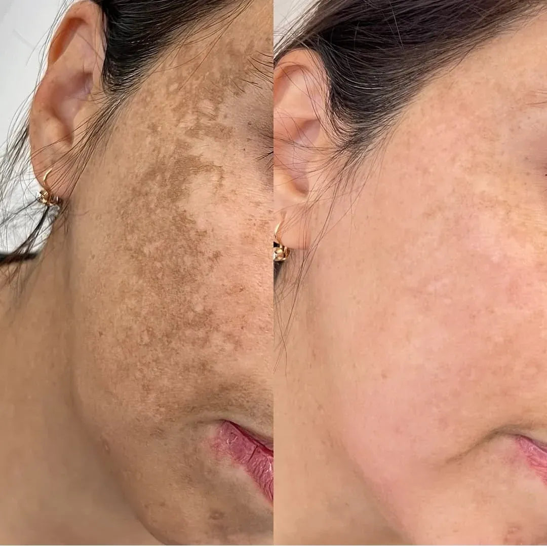 Resveratrol Advanced: Rejuvenecida y Radiante hasta 10 años + Obsequio