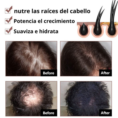 Oferta 2x1, Shampoo HairRegen® Elimina la caída y potencia el crecimiento