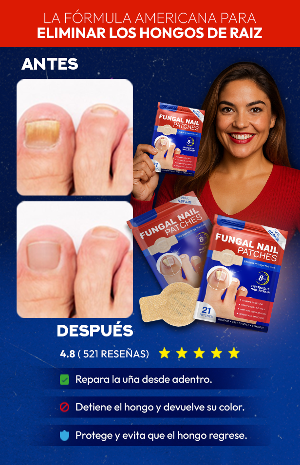 FUNGAL NAILS®  - Elimina los hongos de la uña de raíz