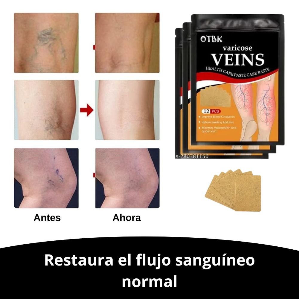 ¡OFERTA 2X1! Tratamiento Varico | Alivio inmediato del dolor y la hinchazón