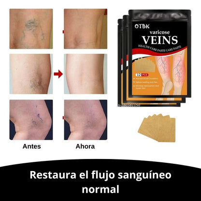 ¡OFERTA 2X1! Tratamiento Varico | Alivio inmediato del dolor y la hinchazón