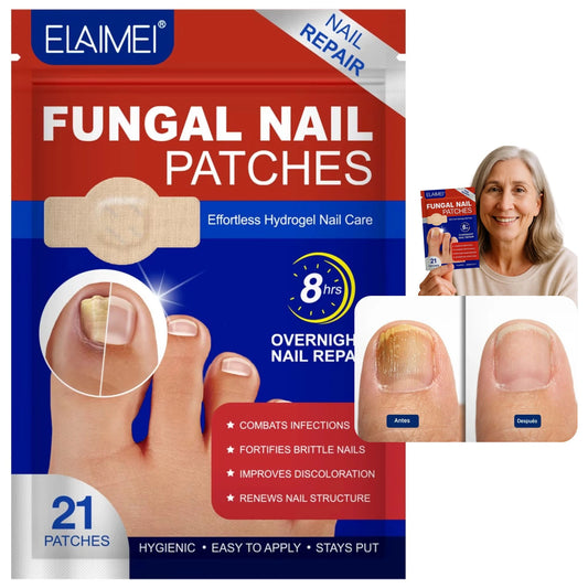Fungal Nails® – No sigas escondiendo tus pies por culpa de los hongos
