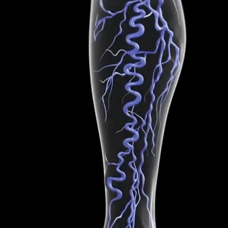 ¡OFERTA 2X1! Tratamiento Varico | Alivio inmediato del dolor y la hinchazón