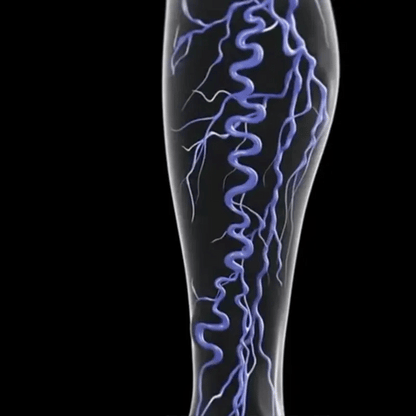 ¡OFERTA 2X1! Tratamiento Varico | Alivio inmediato del dolor y la hinchazón