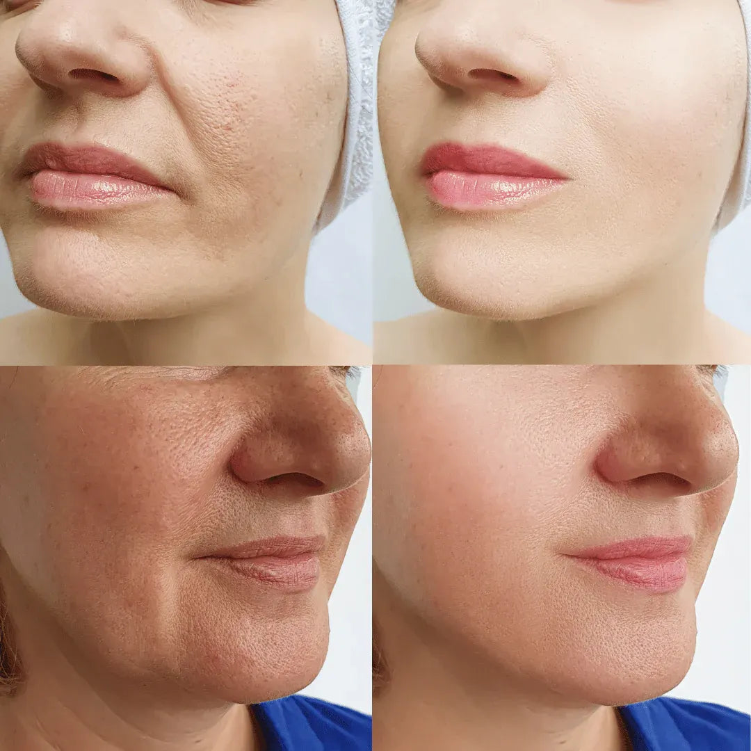 Resveratrol Advanced: Rejuvenecida y Radiante hasta 10 años + Obsequio